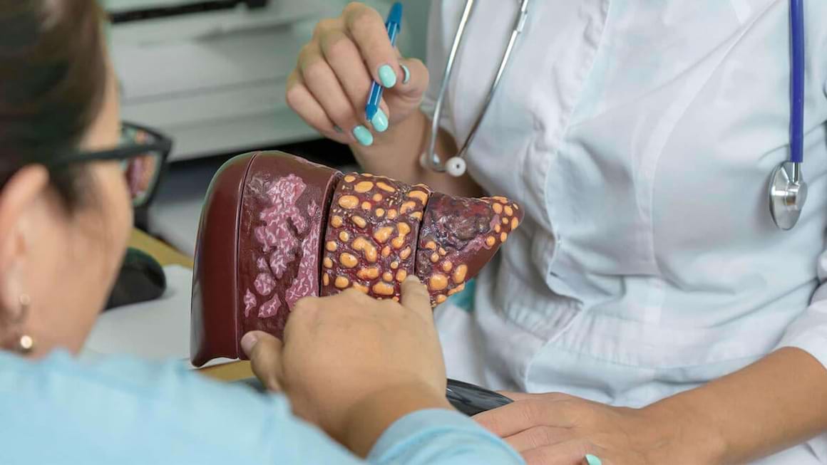 Exista sau nu un tratament standard pentru steatoza hepatica?